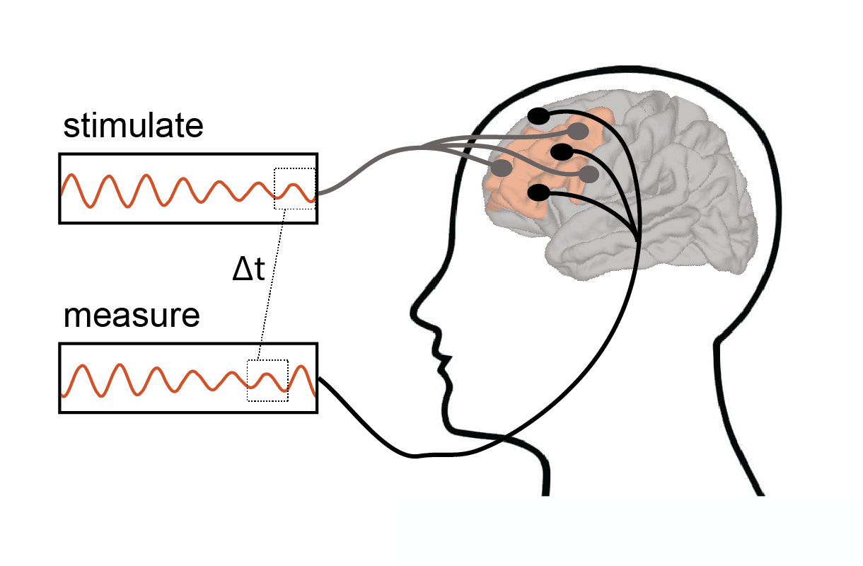 closed-loop